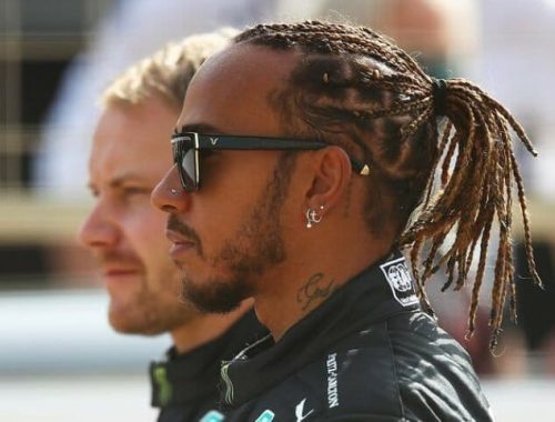 Did Lewis Hamilton Have a Hair Transplant?