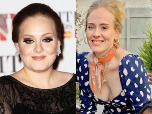 Adele Before and After Plastic Surgery and Weight Loss