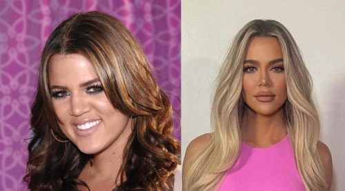 Khloe Kardashian plastic surgery