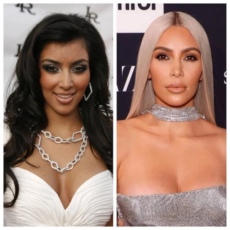Kim Kardashian's Plastic Surgery Journey Vanity