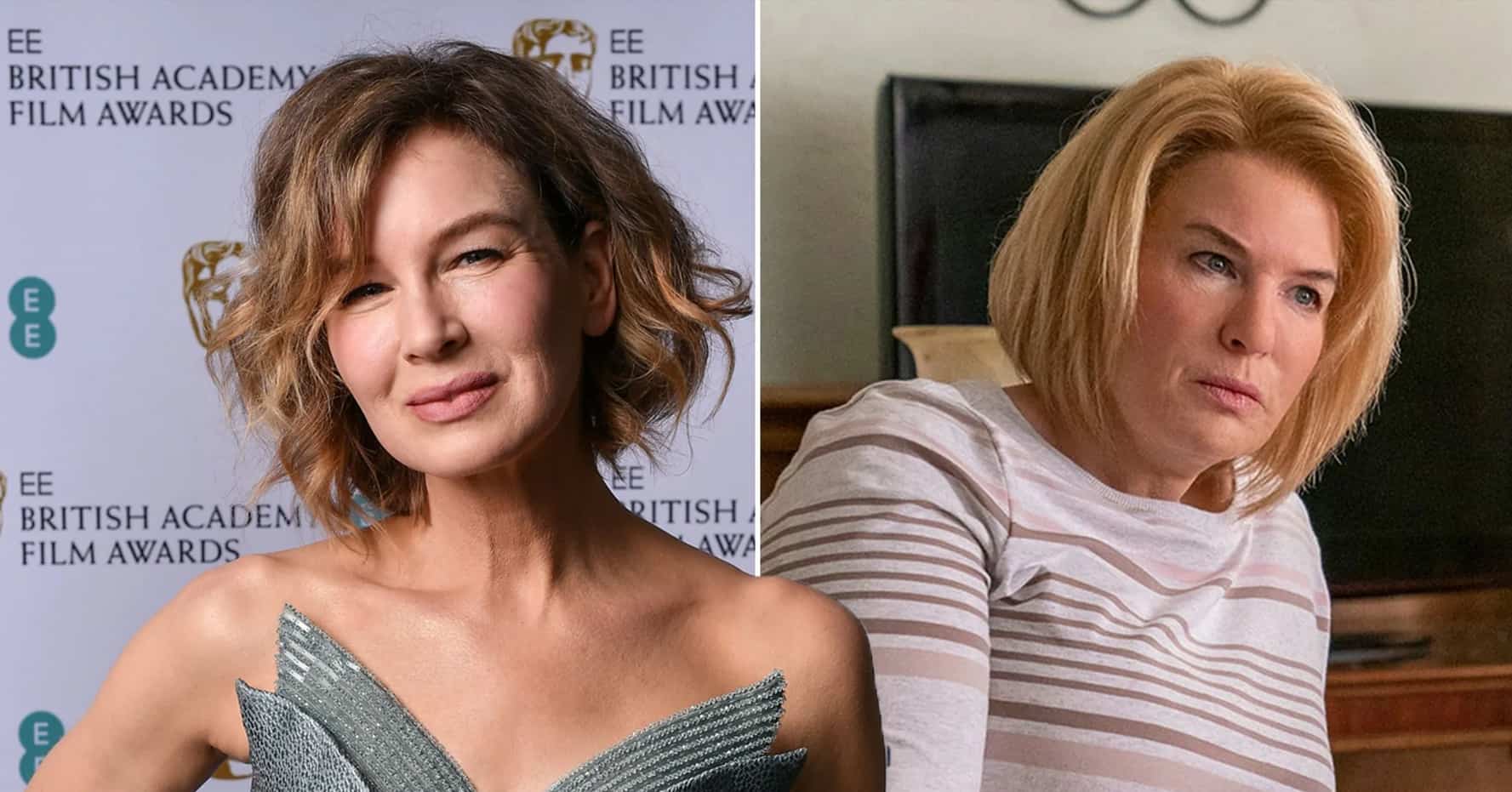 Renée Zellweger Before and After Plastic Surgery - Vanity